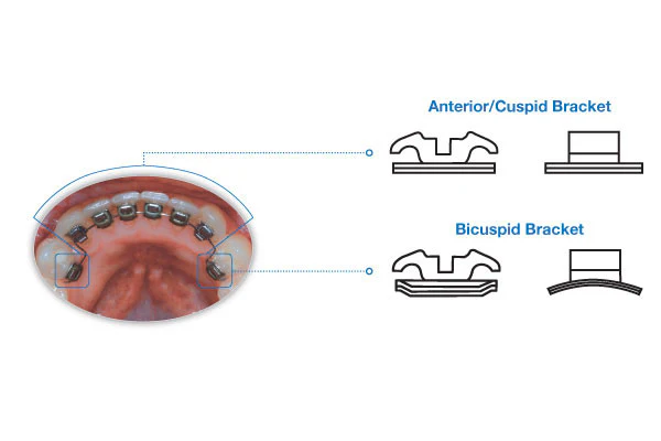 Ideal Brackets