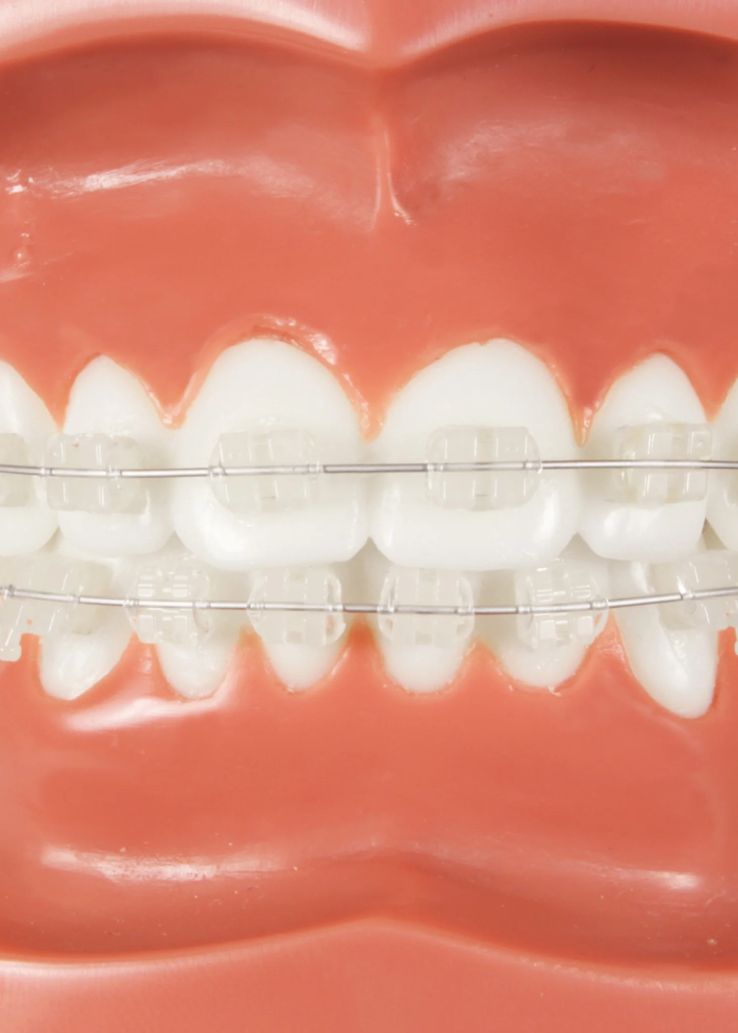 Ilusio Nickel Titanium Archwire - Image 2