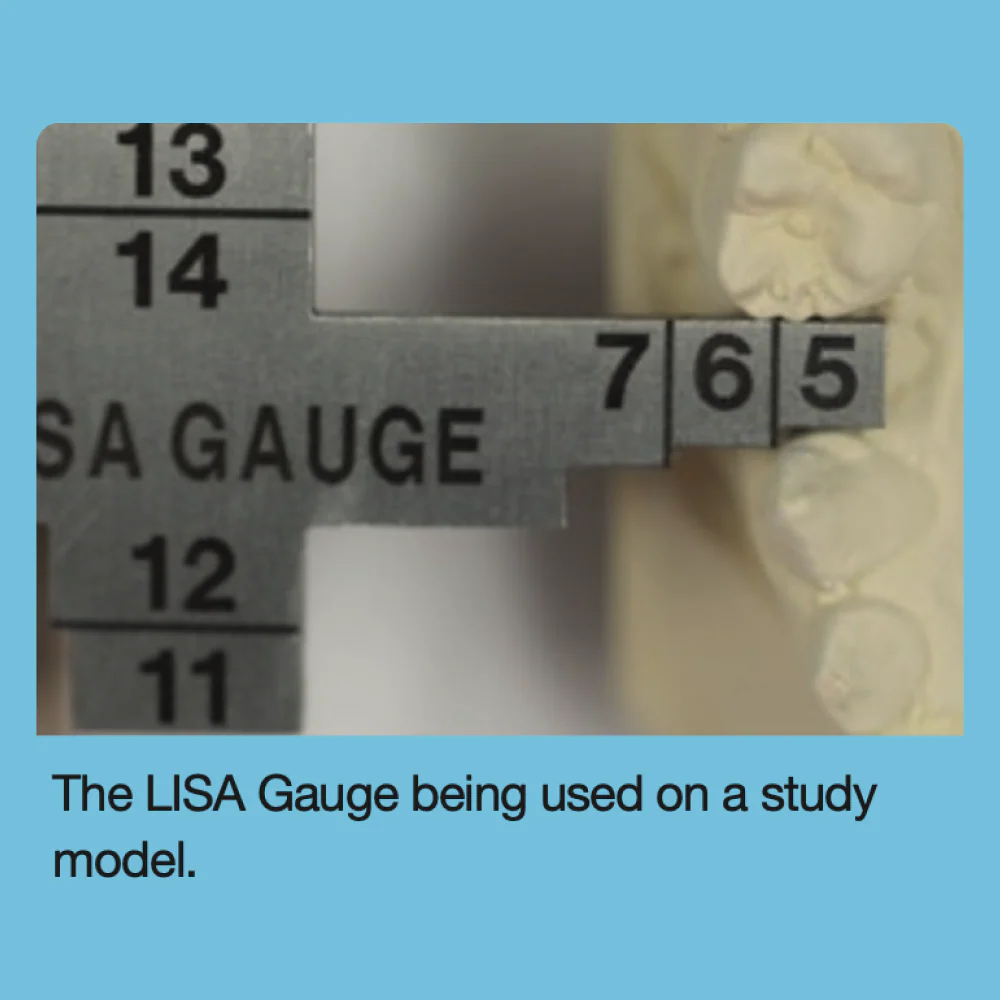 LISA Gauge - Image 5
