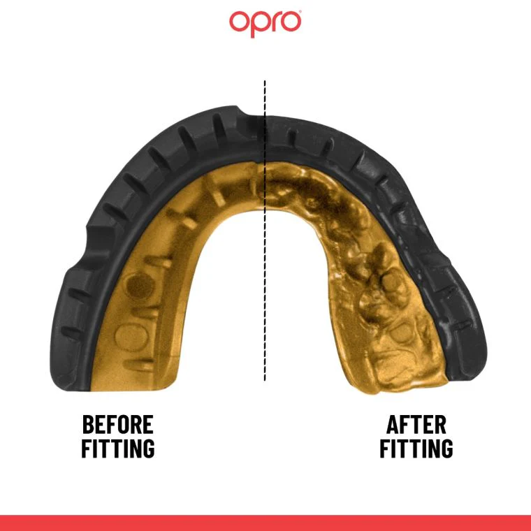 OPRO Self-Fit - Gold Braces - Image 7